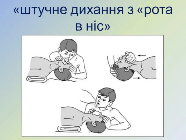 «штучне дихання з «рота в ніс»