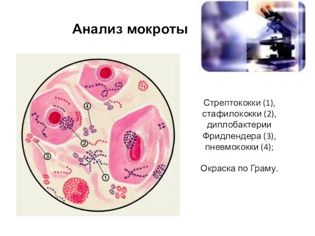 Стрептококки (1), стафилококки (2), диплобактерии Фридлендера (3), пневмококки (4); Окраска по Граму. Анализ мокроты