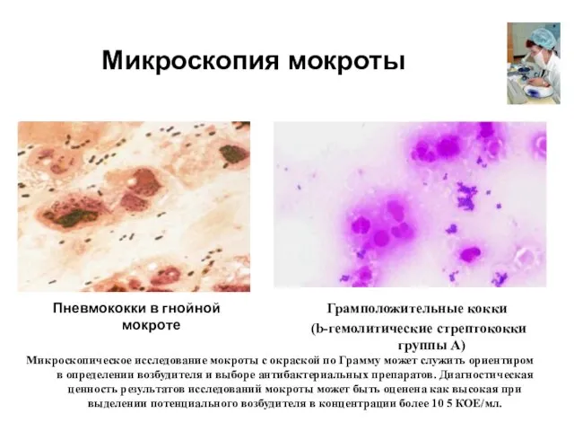 Микроскопия мокроты Пневмококки в гнойной мокроте Грамположительные кокки (b-гемолитические стрептококки