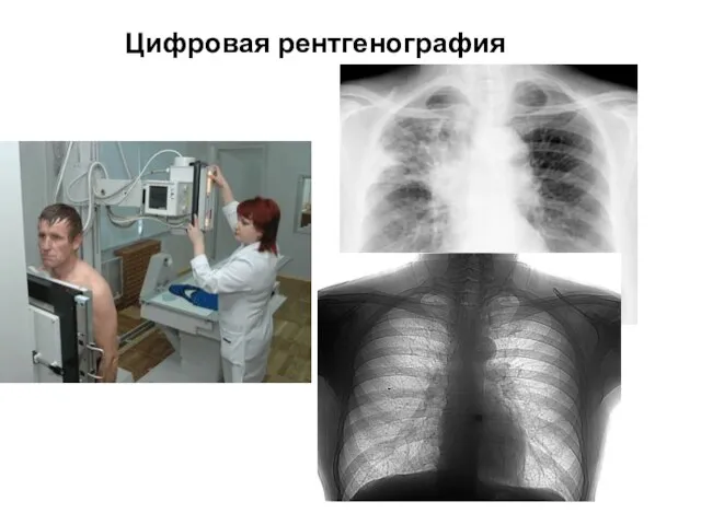 Цифровая рентгенография