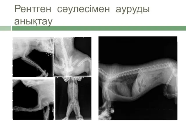 Рентген сәулесімен ауруды анықтау