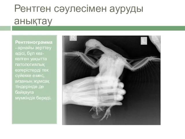 Рентген сәулесімен ауруды анықтау Рентгенограмма - арнайы зерттеу әдісі, бұл