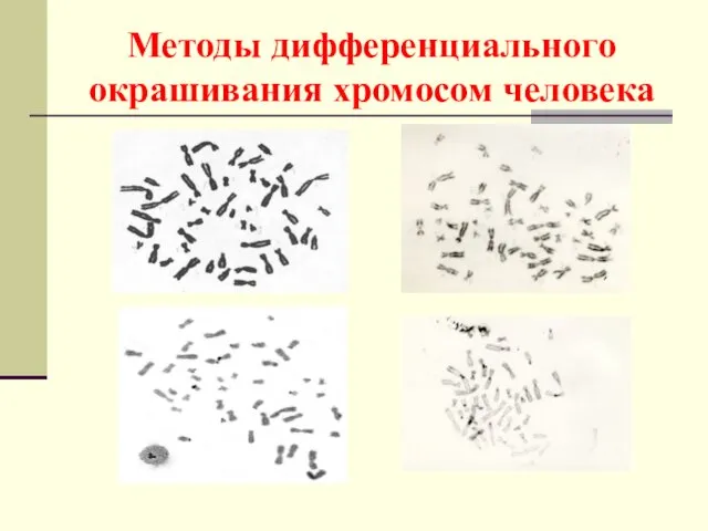 Методы дифференциального окрашивания хромосом человека