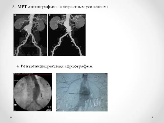 3. МРТ-ангиография с контрастным усилением; 4. Рентгенконтрастная аортография.