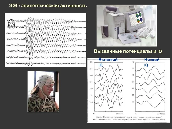 Вызванные потенциалы и IQ ЭЭГ: эпилептическая активность