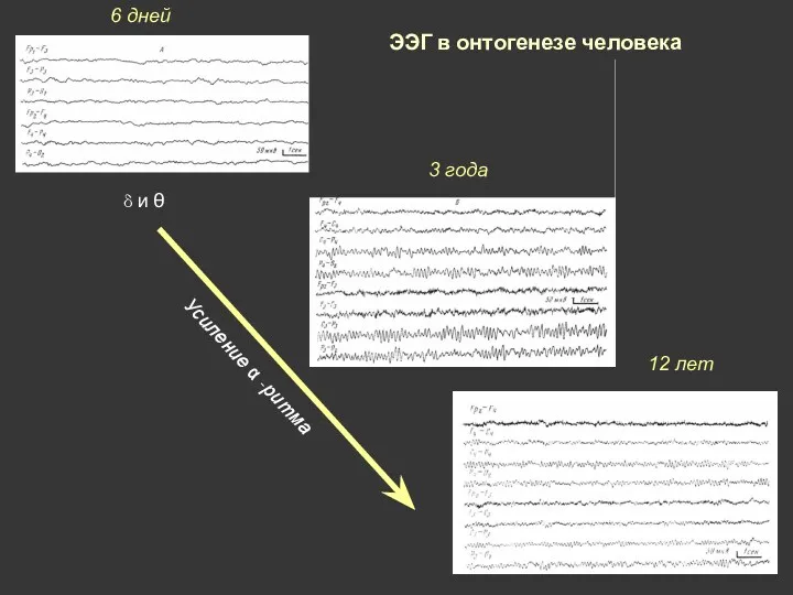 ЭЭГ в онтогенезе человека 6 дней 3 года 12 лет δ и θ Усиление α -ритма