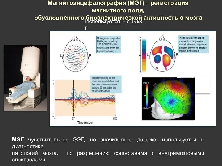 Магнитоэнцефалография (МЭГ) – регистрация магнитного поля, обусловленного биоэлектрической активностью мозга