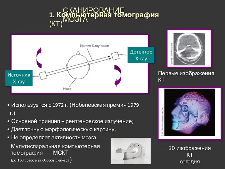 СКАНИРОВАНИЕ МОЗГА 1. Компьютерная томография (КТ) Первые изображения КТ 3D