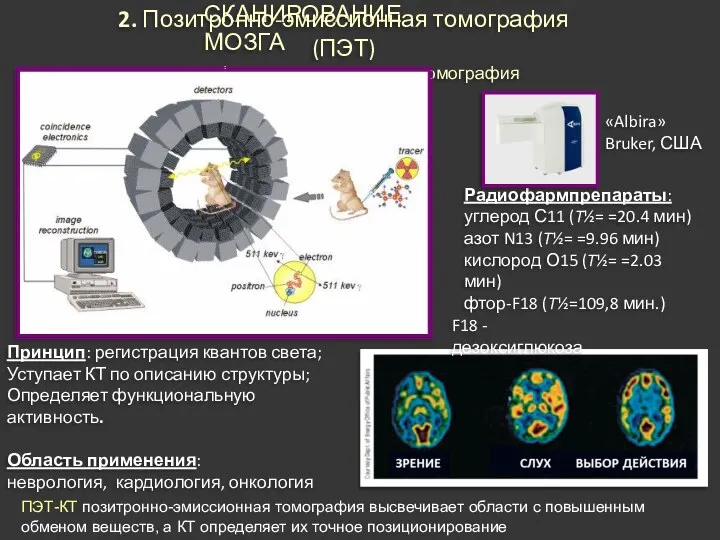 СКАНИРОВАНИЕ МОЗГА 2. Позитронно-эмиссионная томография (ПЭТ) = двухфотонная эмиссионная томография