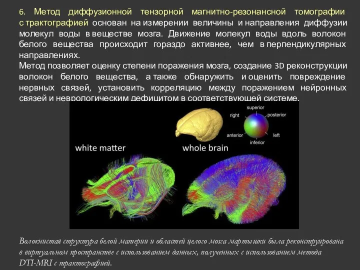 6. Метод диффузионной тензорной магнитно-резонансной томографии с трактографией основан на