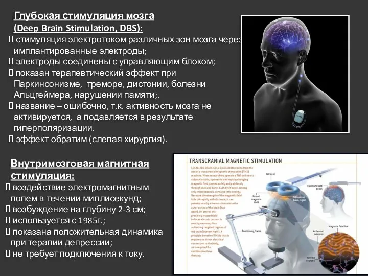 Внутримозговая магнитная стимуляция: воздействие электромагнитным полем в течении миллисекунд; возбуждение