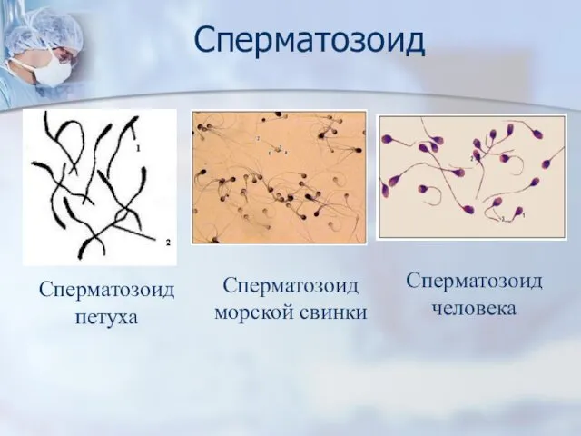 Сперматозоид Сперматозоид петуха Сперматозоид морской свинки Сперматозоид человека