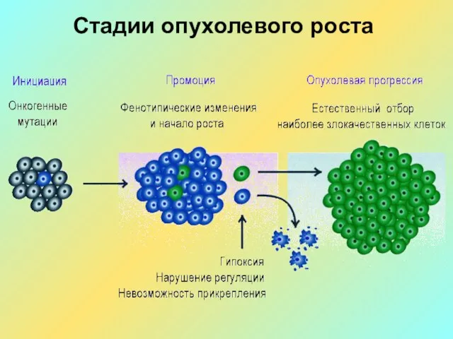 Стадии опухолевого роста