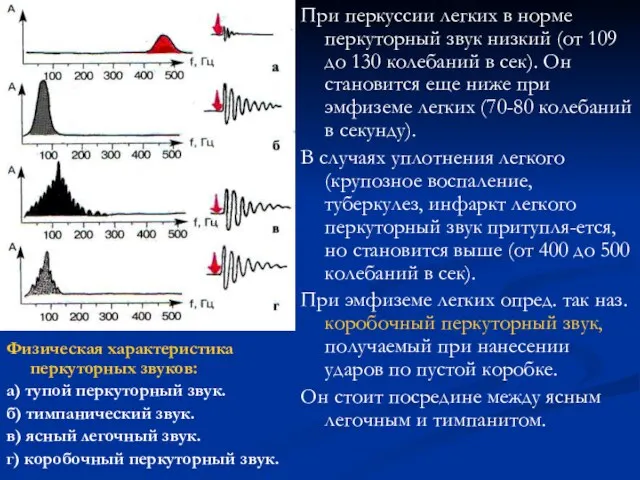 Физическая характеристика перкуторных звуков: а) тупой перкуторный звук. б) тимпанический