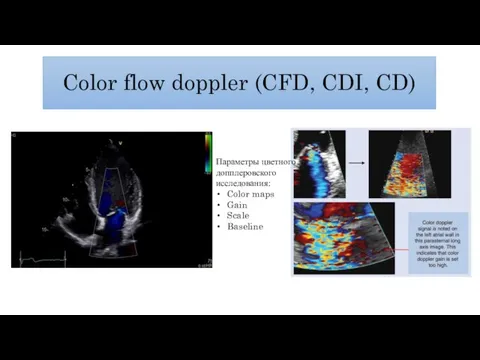 Color flow doppler (CFD, CDI, CD) Параметры цветного допплеровского исследования: Color maps Gain Scale Baseline