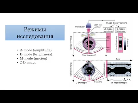 Режимы исследования A-mode (amplitude) B-mode (brightness) M-mode (motion) 2-D image