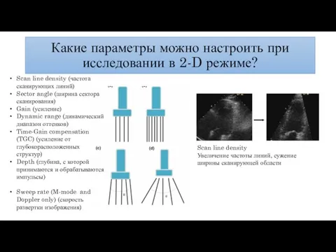 Какие параметры можно настроить при исследовании в 2-D режиме? Scan