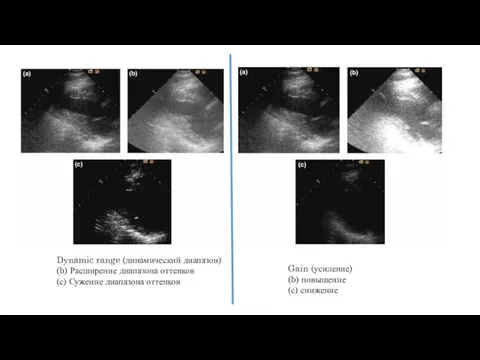 Dynamic range (динамический диапазон) (b) Расширение диапазона оттенков (с) Сужение