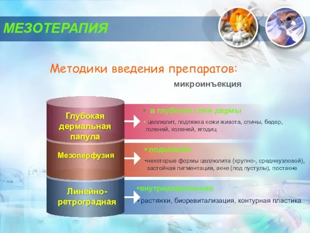 МЕЗОТЕРАПИЯ в глубокий слой дермы целлюлит, подтяжка кожи живота, спины,