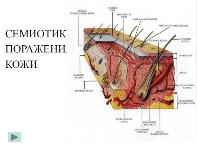 СЕМИОТИКА ПОРАЖЕНИЯ КОЖИ