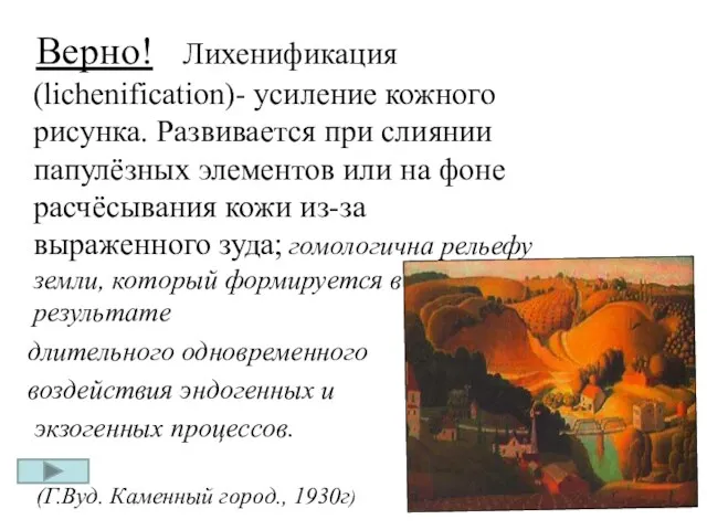 Верно! Лихенификация (lichenification)- усиление кожного рисунка. Развивается при слиянии папулёзных