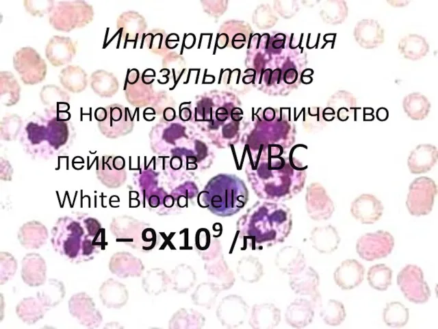 Интерпретация результатов В норме общее количество лейкоцитов WBC White Blood Cells 4 – 9х109 /л.