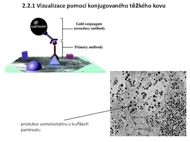 2.2.1 Vizualizace pomocí konjugovaného těžkého kovu produkce somatostatinu v buňkách pankreatu