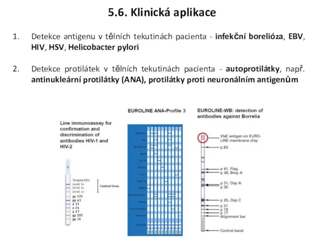 Detekce antigenu v tělních tekutinách pacienta - infekční borelióza, EBV,