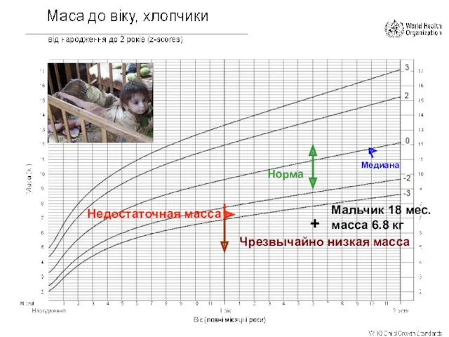 Медиана Недостаточная масса Норма Чрезвычайно низкая масса + Мальчик 18 мес. масса 6.8 кг