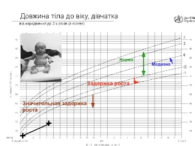 Медиана Задержка роста Норма Значительная задержка роста + +