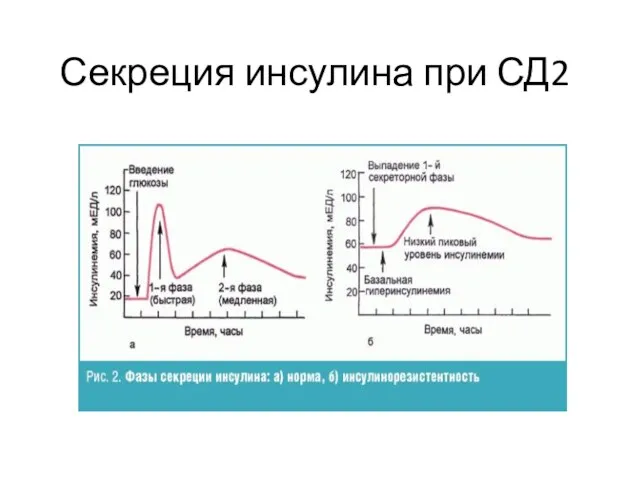 Секреция инсулина при СД2