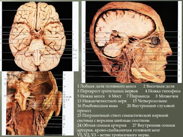 1 Лобная доля головного мозга 2 Височная доля 3 Перекрест зрительных нервов 4