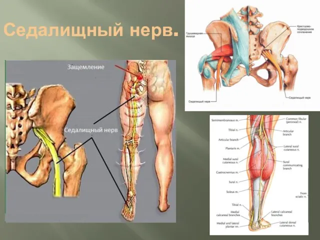 Седалищный нерв.