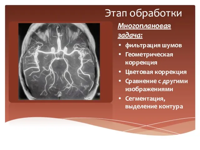 Этап обработки Многоплановая задача: фильтрация шумов Геометрическая коррекция Цветовая коррекция