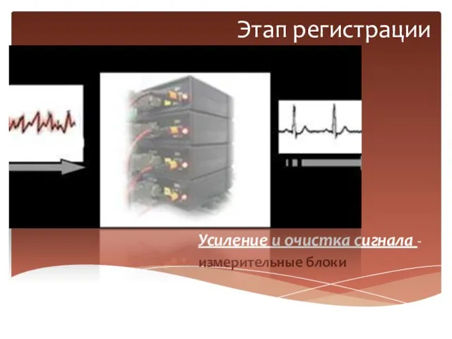 Этап регистрации Усиление и очистка сигнала - измерительные блоки