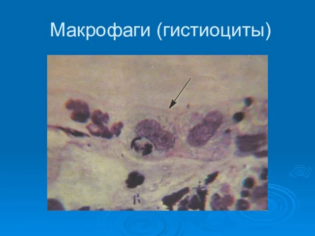 Макрофаги (гистиоциты)