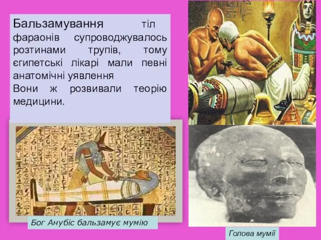 Бог Анубіс бальзамує мумію Бальзамування тіл фараонів супроводжувалось розтинами трупів, тому єгипетські лікарі