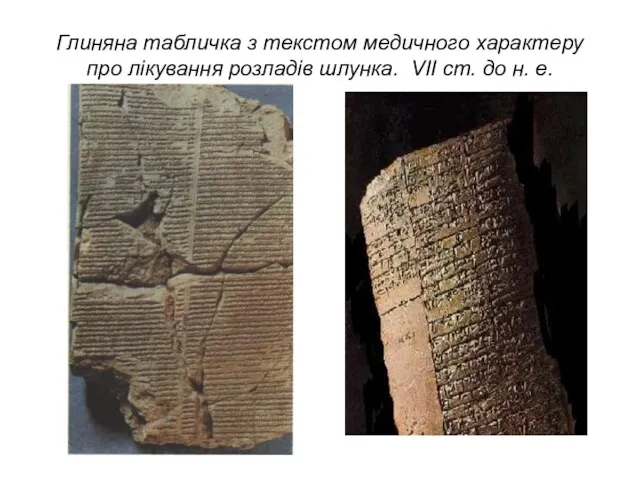 Глиняна табличка з текстом медичного характеру про лікування розладів шлунка. VII ст. до н. е.