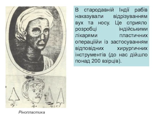 В стародавній Індії рабів наказували відрізуванням вух та носу. Це сприяло розробці індійськими