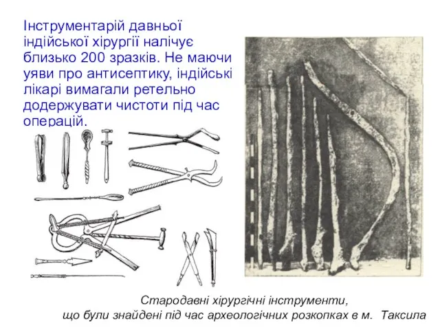 Стародавні хірургічні інструменти, що були знайдені під час археологічних розкопках в м. Таксила