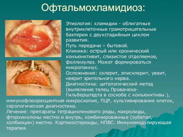 Офтальмохламидиоз: Этиология: хламидии - облигатные внутриклеточные грамотрицательные бактерии с двухстадийным