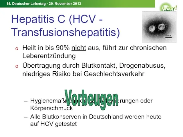Hepatitis C (HCV - Transfusionshepatitis) Heilt in bis 90% nicht aus, führt zur