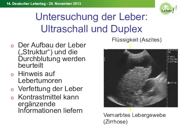 Untersuchung der Leber: Ultraschall und Duplex Der Aufbau der Leber