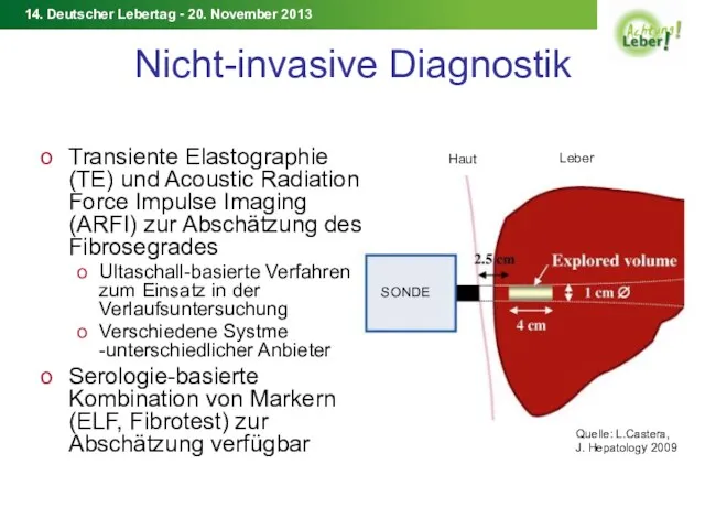 Nicht-invasive Diagnostik Transiente Elastographie (TE) und Acoustic Radiation Force Impulse Imaging (ARFI) zur