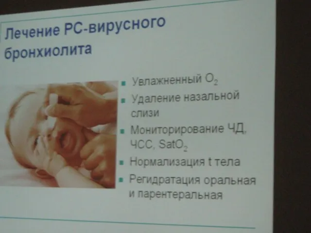 Уровень поражения респираторного тракта Ринит и назофарингит (МКБ-10: J00) Фарингит