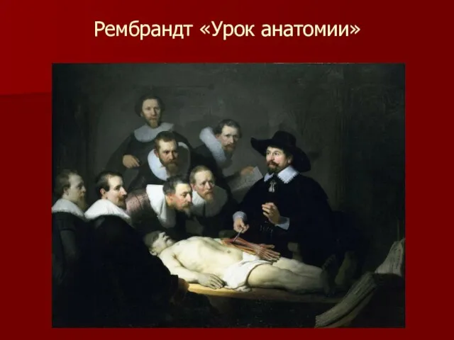 Рембрандт «Урок анатомии»