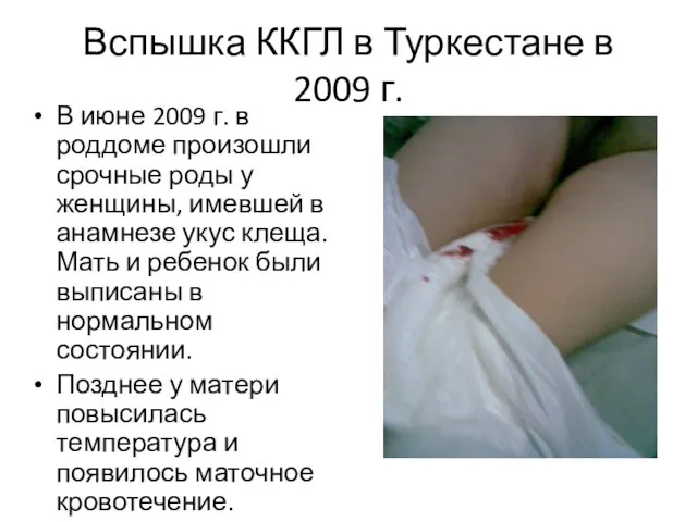 Вспышка ККГЛ в Туркестане в 2009 г. В июне 2009