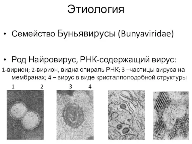 Этиология Семейство Буньявирусы (Bunyaviridae) Род Найровирус, РНК-содержащий вирус: 1-вирион; 2-вирион,