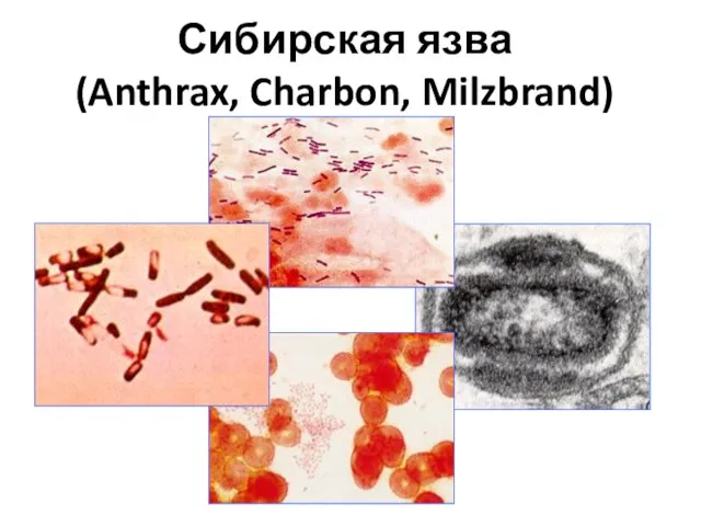 Сибирская язва (Anthrax, Charbon, Milzbrand)