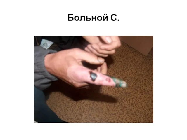 Больной С.